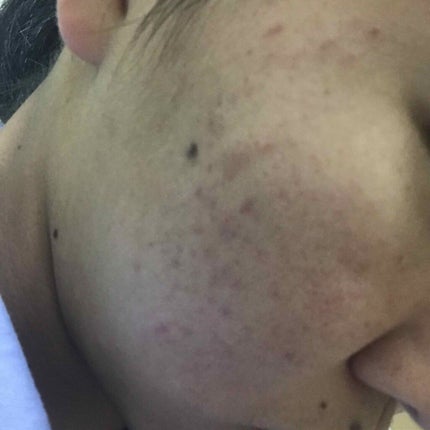 ハトムギ化粧水(ナチュリエ スキンコンディショナー R )/ナチュリエ/化粧水を使ったクチコミ(3枚目)