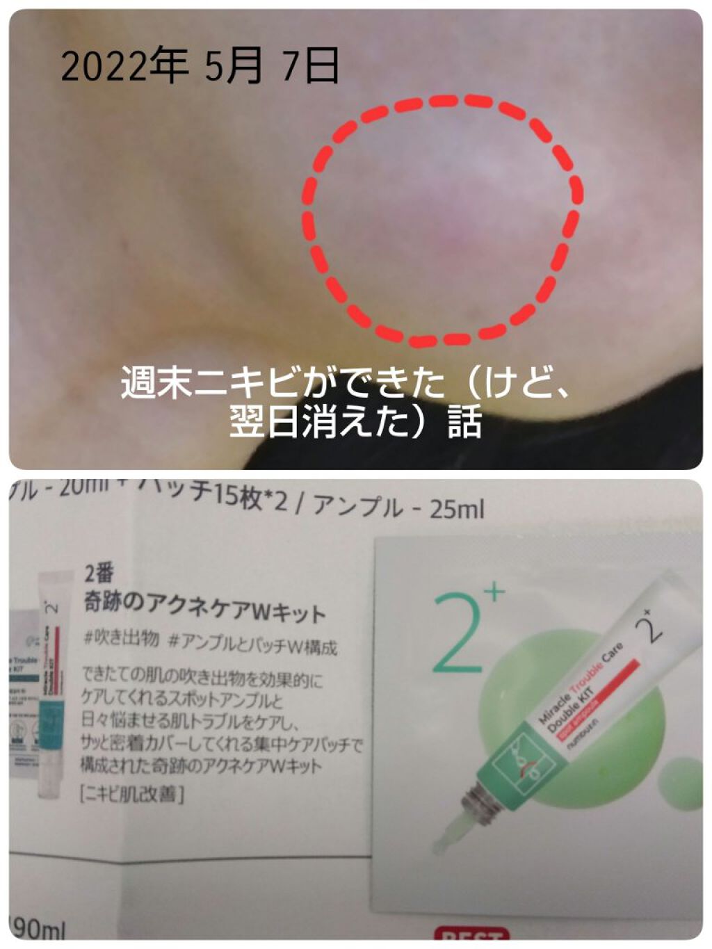 2番 奇跡のトラブルケアWキット/numbuzin/にきびパッチを使ったクチコミ（1枚目）