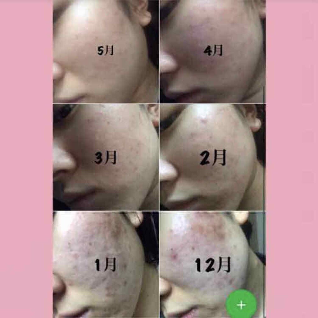 フローラドリップ/ALBION/化粧水を使ったクチコミ(2枚目)