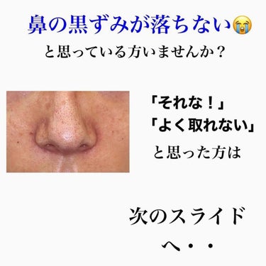 kento@パーソナルスキンケア on LIPS 「こんばんは！けんとです！鼻の黒ずみ、いちご鼻に効いた方法を紹介..」（2枚目）