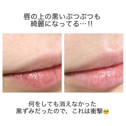 ポアフィットウォータートナー/Feld Apotheke/化粧水を使ったクチコミ(7枚目)