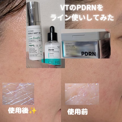 リードルショット300/VT/美容液を使ったクチコミ(4枚目)