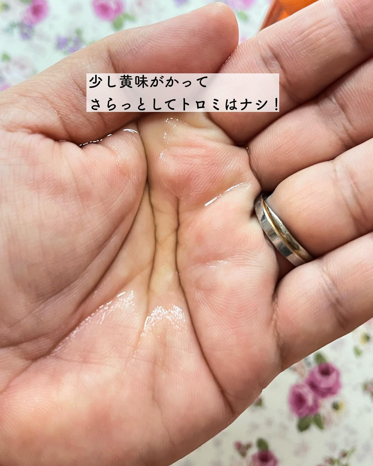 エンリッチ ローション/サイクルプラス/化粧水を使ったクチコミ(6枚目)