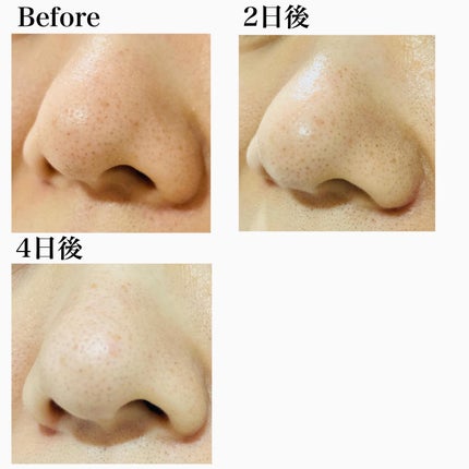 アンジエンド マイクロクレンジングバーム/シーヴァ/クレンジングバームを使ったクチコミ(7枚目)