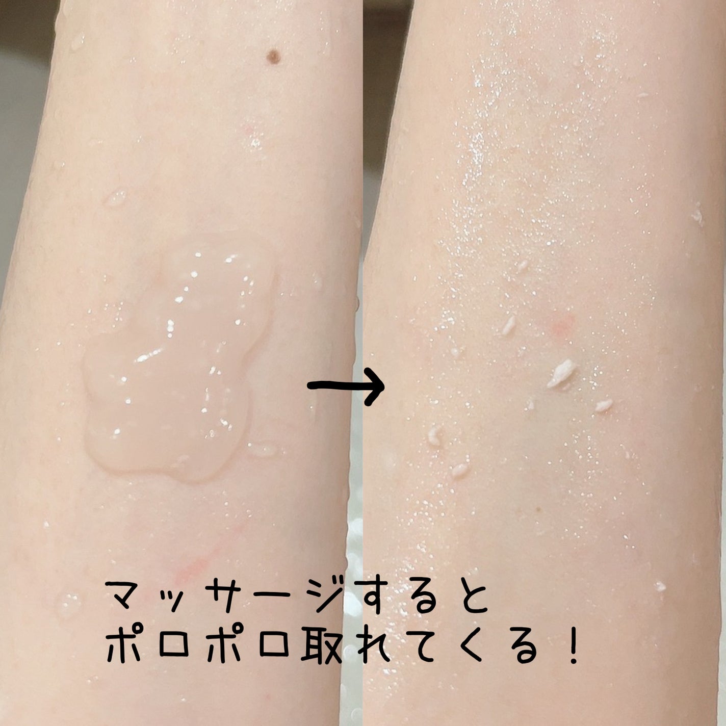 しっとりピーリング/毛穴撫子/ピーリングを使ったクチコミ(2枚目)