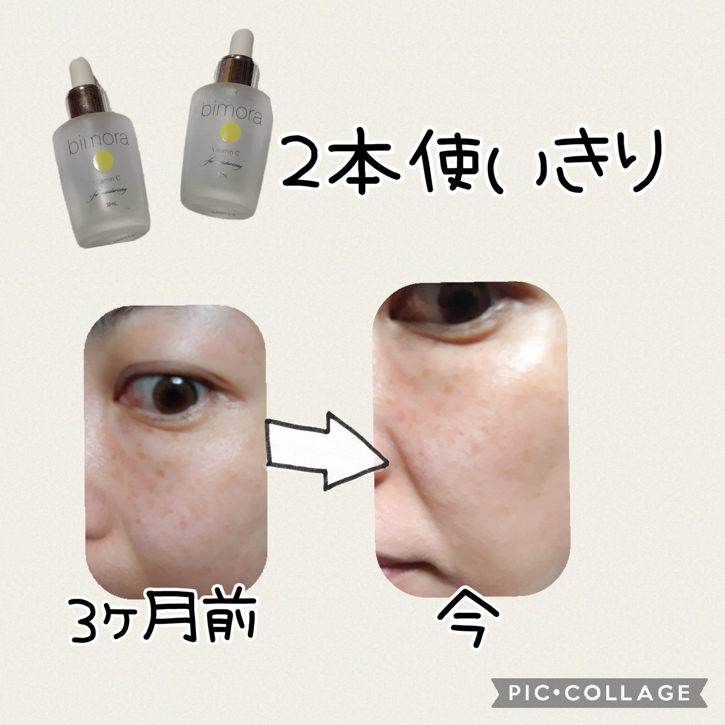 ビモラコスメ VC/BimoRa/美容液を使ったクチコミ(2枚目)