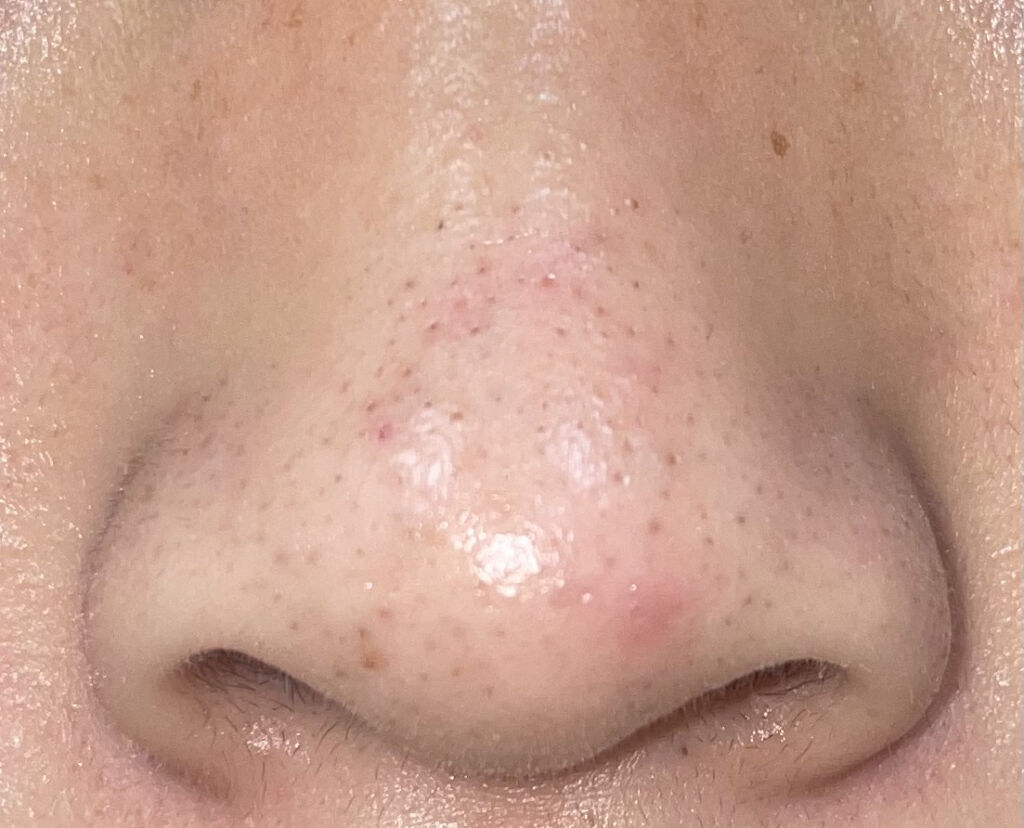 クレンジングバーム/ink./クレンジングバームを使ったクチコミ（1枚目）