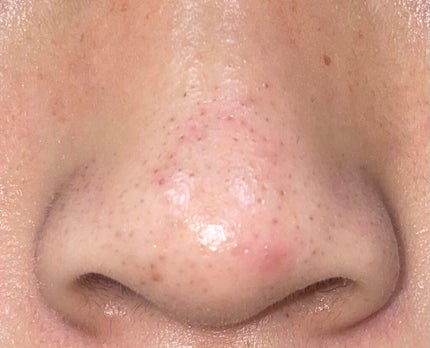 クレンジングバーム/ink./クレンジングバームを使ったクチコミ(1枚目)