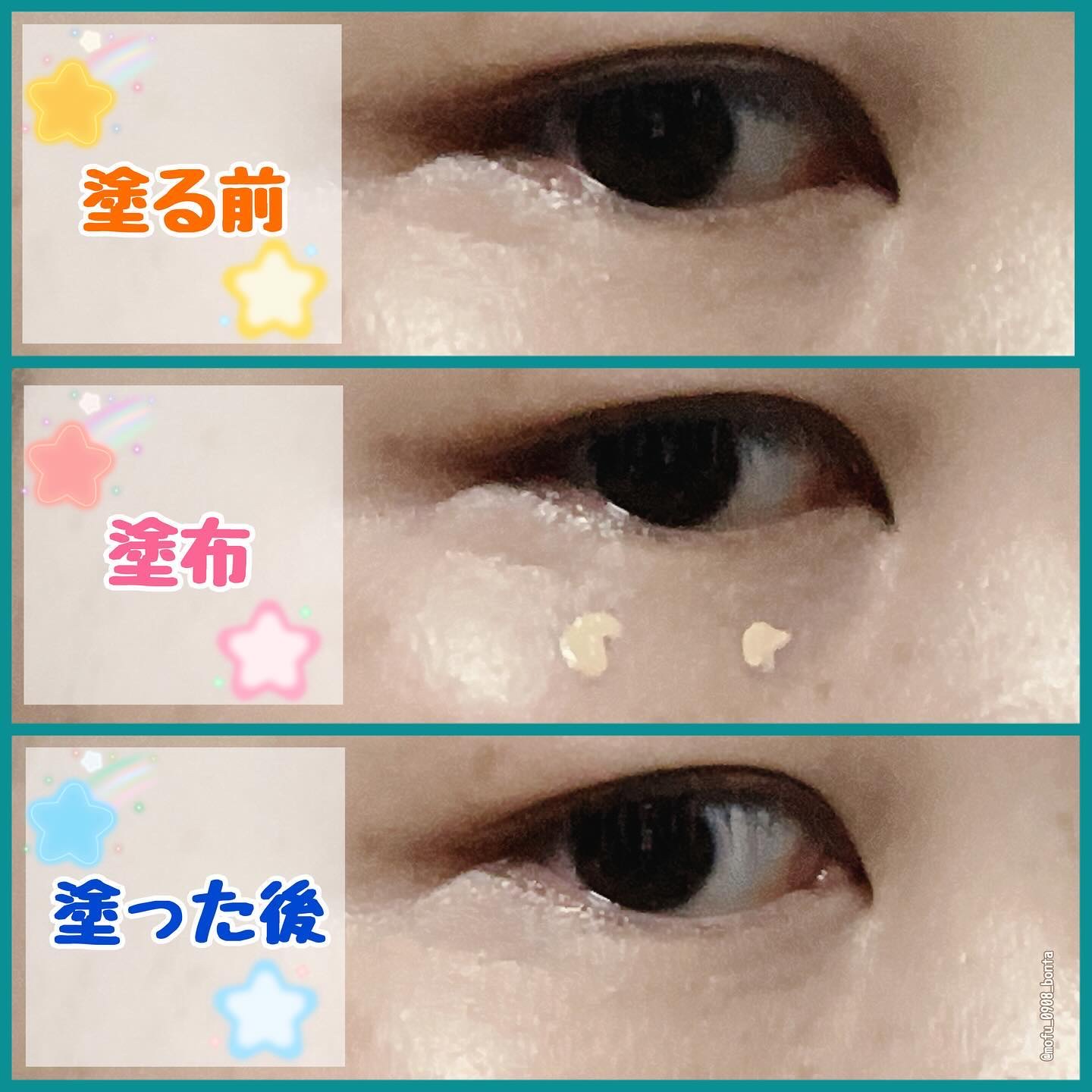 タトゥーウォータープルーフスカーコンシーラー 02 ナチュラルベージュ/フォレンコス/リキッドコンシーラーを使ったクチコミ（3枚目）