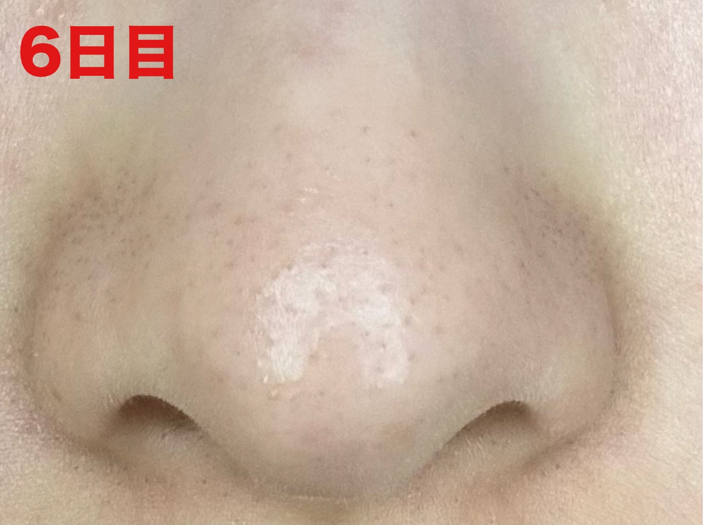 ディープクリア酵素洗顔	/メラノCC/洗顔フォームを使ったクチコミ（2枚目）