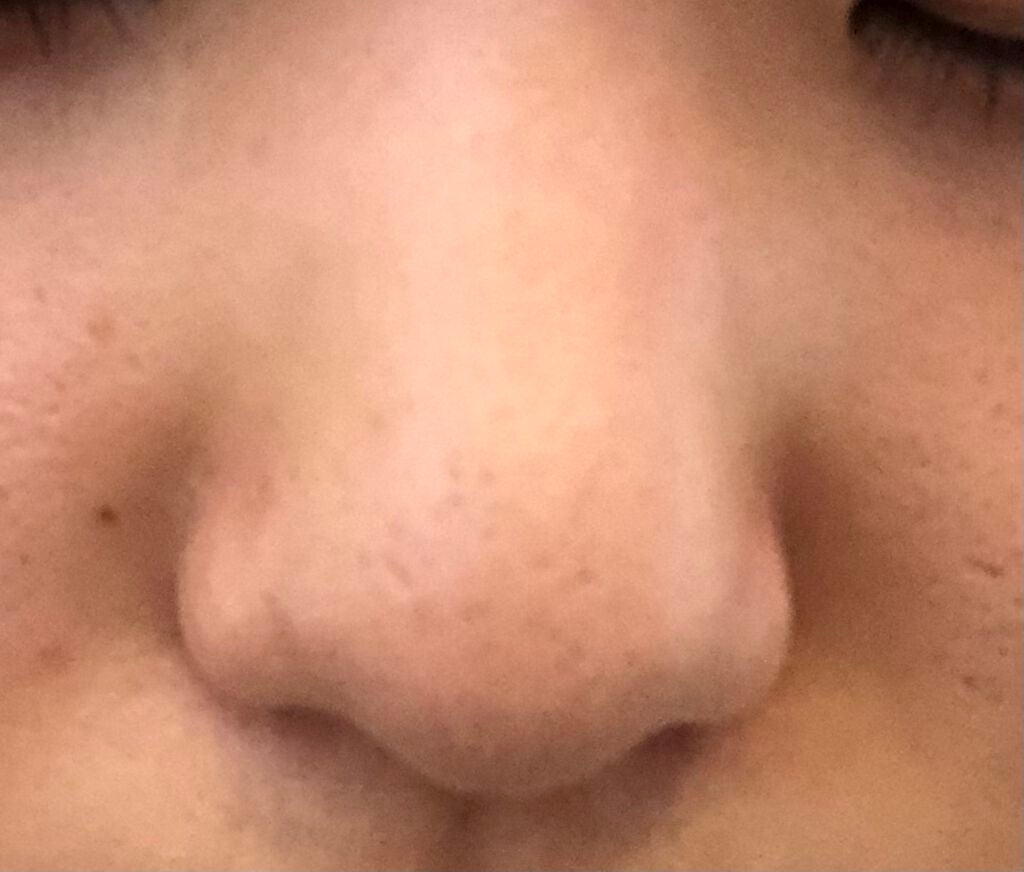 ハトムギ化粧水(ナチュリエ スキンコンディショナー R )/ナチュリエ/化粧水を使ったクチコミ(3枚目)