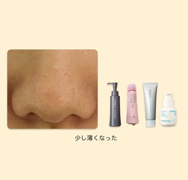 パーフェクトホイップu/SENKA（専科）/洗顔フォームを使ったクチコミ（9枚目）