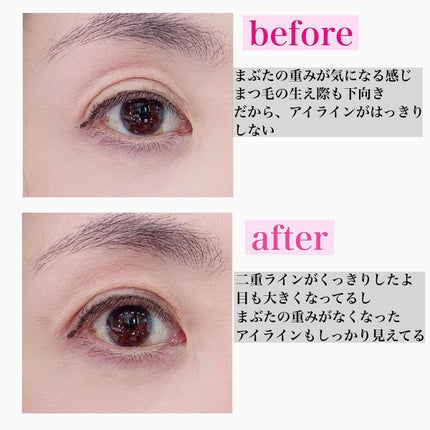 メザイク クリップ カッター ファイバー専用カッター/メザイク/二重まぶた用アイテムを使ったクチコミ(6枚目)