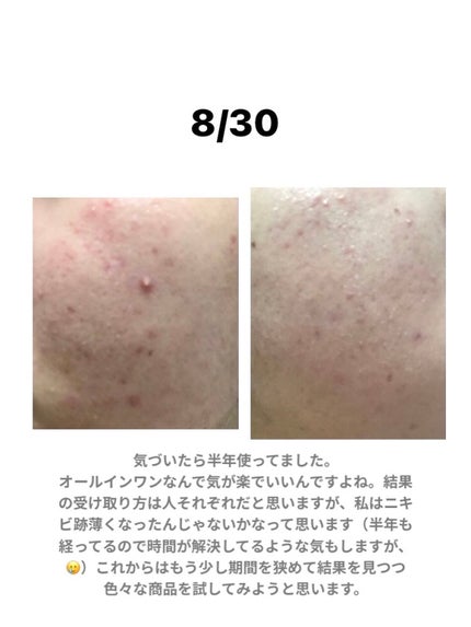モイスチュアマイルドホワイト パーフェクトエッセンス/モイスチュアマイルド ホワイト/オールインワン化粧品を使ったクチコミ(3枚目)