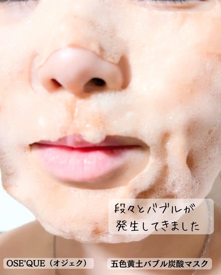 OSEQUE DUAL SKINCARE BUBBLE MASK/OSEQUE/シートマスク・パックを使ったクチコミ(5枚目)