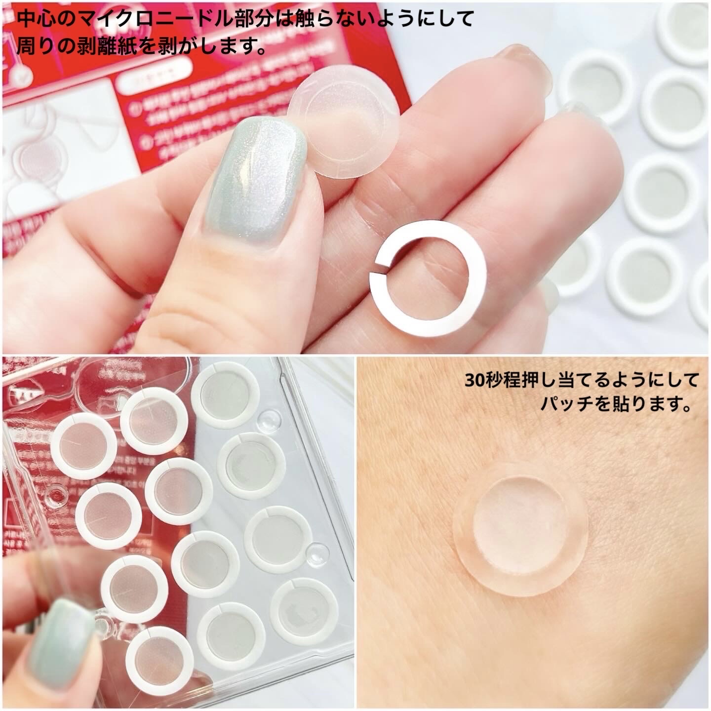 エーキュアショットスポットパッチ/obsero/にきびパッチを使ったクチコミ（3枚目）