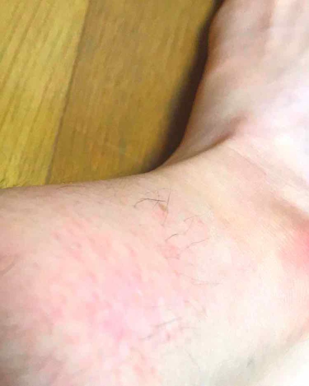 モテ肌  除毛パッド/セリア/ムダ毛ケアを使ったクチコミ（2枚目）