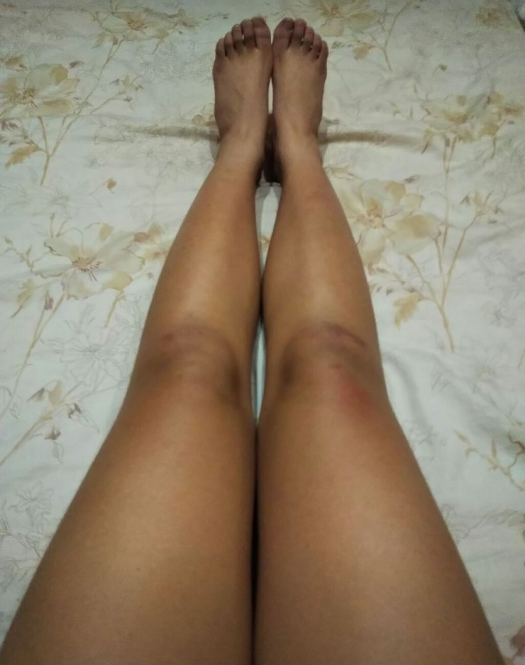 ハトムギ化粧水(ナチュリエ スキンコンディショナー R )/ナチュリエ/化粧水を使ったクチコミ（2枚目）