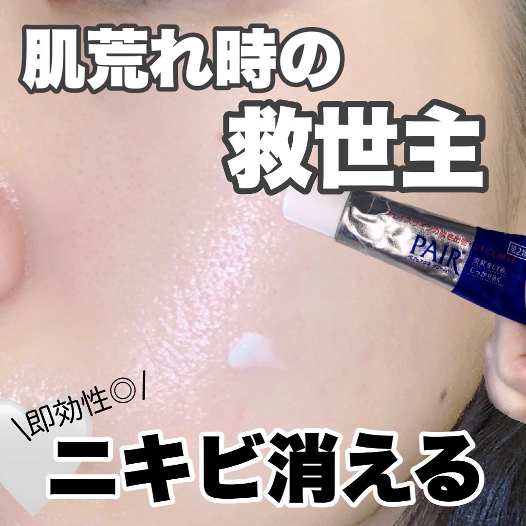 ペアアクネクリームW(医薬品)/ペア/その他を使ったクチコミ（1枚目）