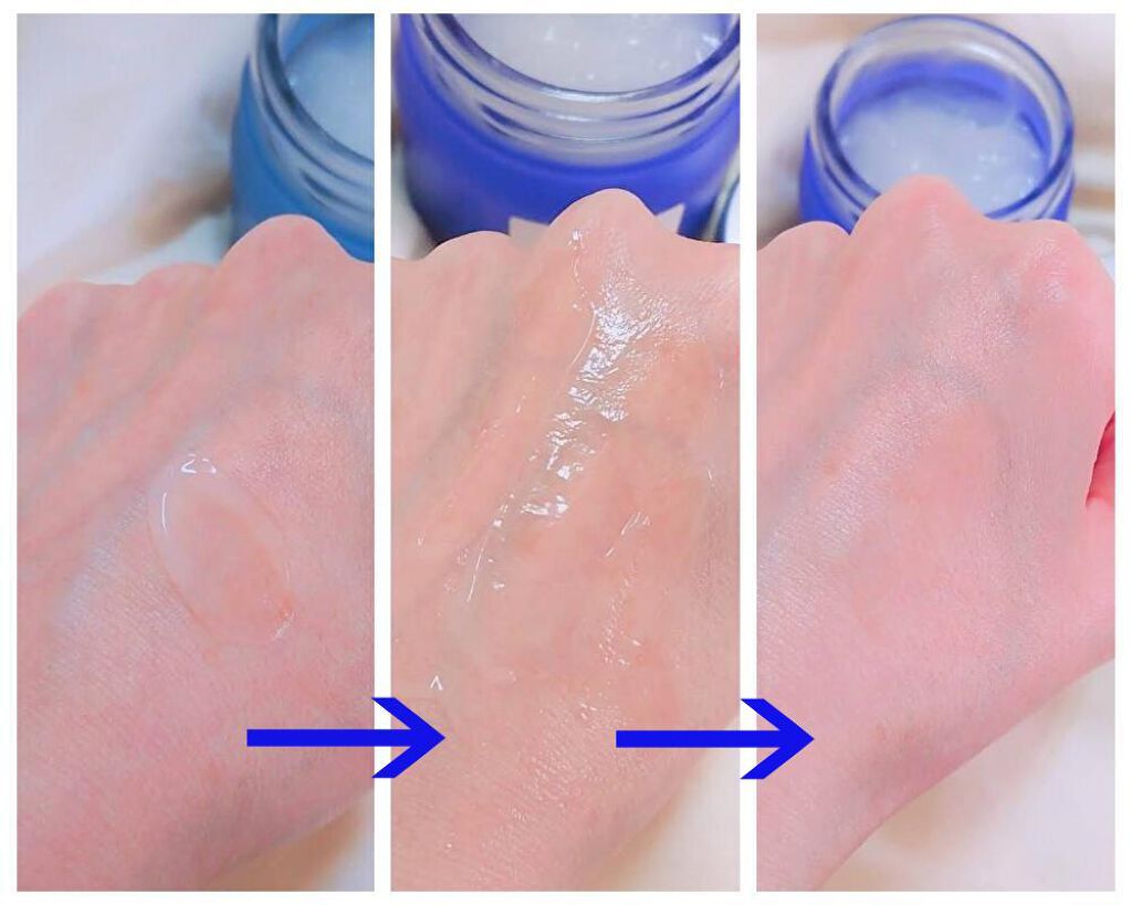 タカミスキンピールボディ/タカミ/ボディローションを使ったクチコミ（2枚目）