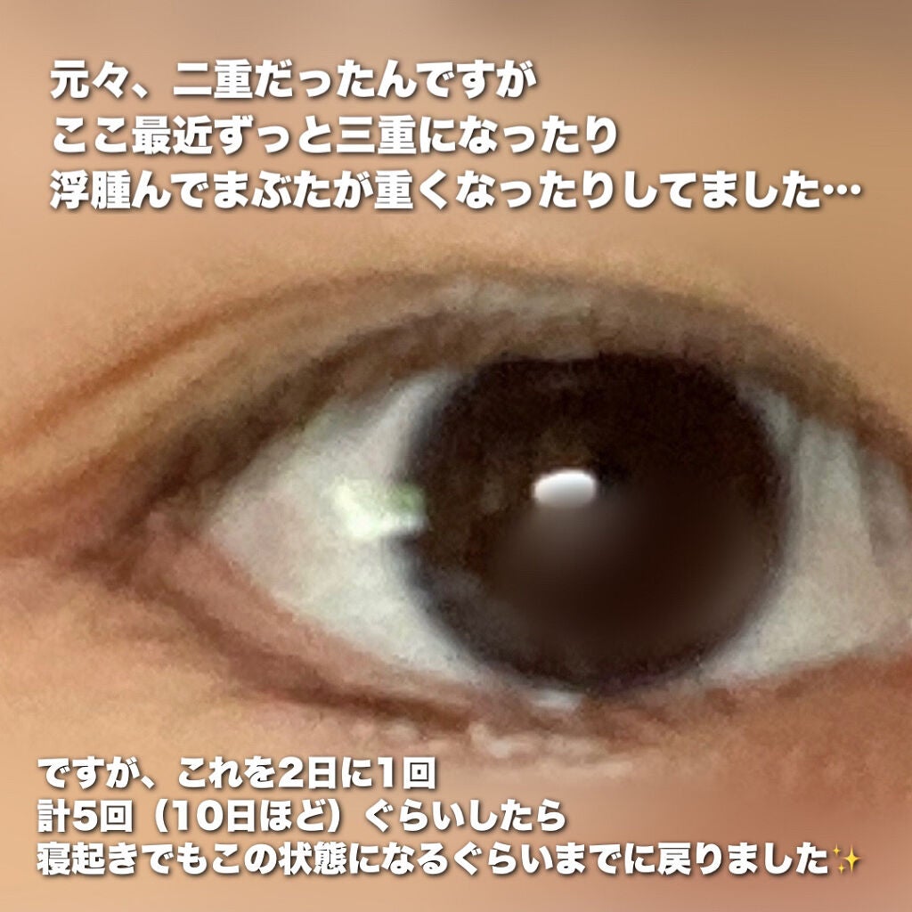 オリシキ アイリッドスキンフィルム /D-UP/二重まぶた用アイテムを使ったクチコミ(5枚目)