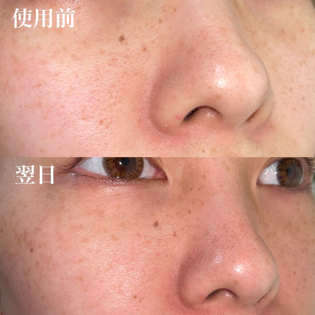 ミラミックス/ZO Skin Health/フェイスクリームを使ったクチコミ（2枚目）