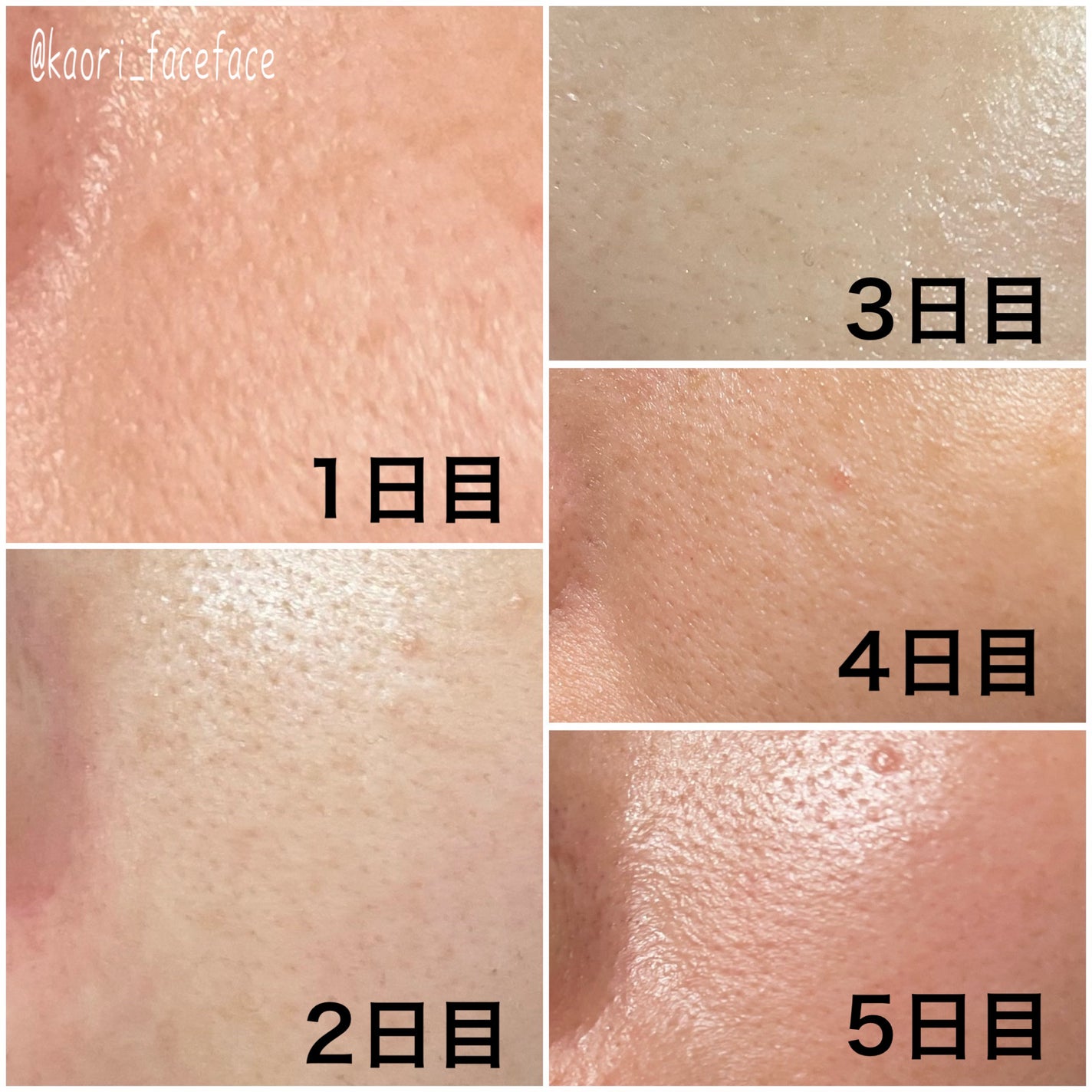 ゼロ毛穴1DAYセラム/MEDICUBE/美容液を使ったクチコミ(2枚目)