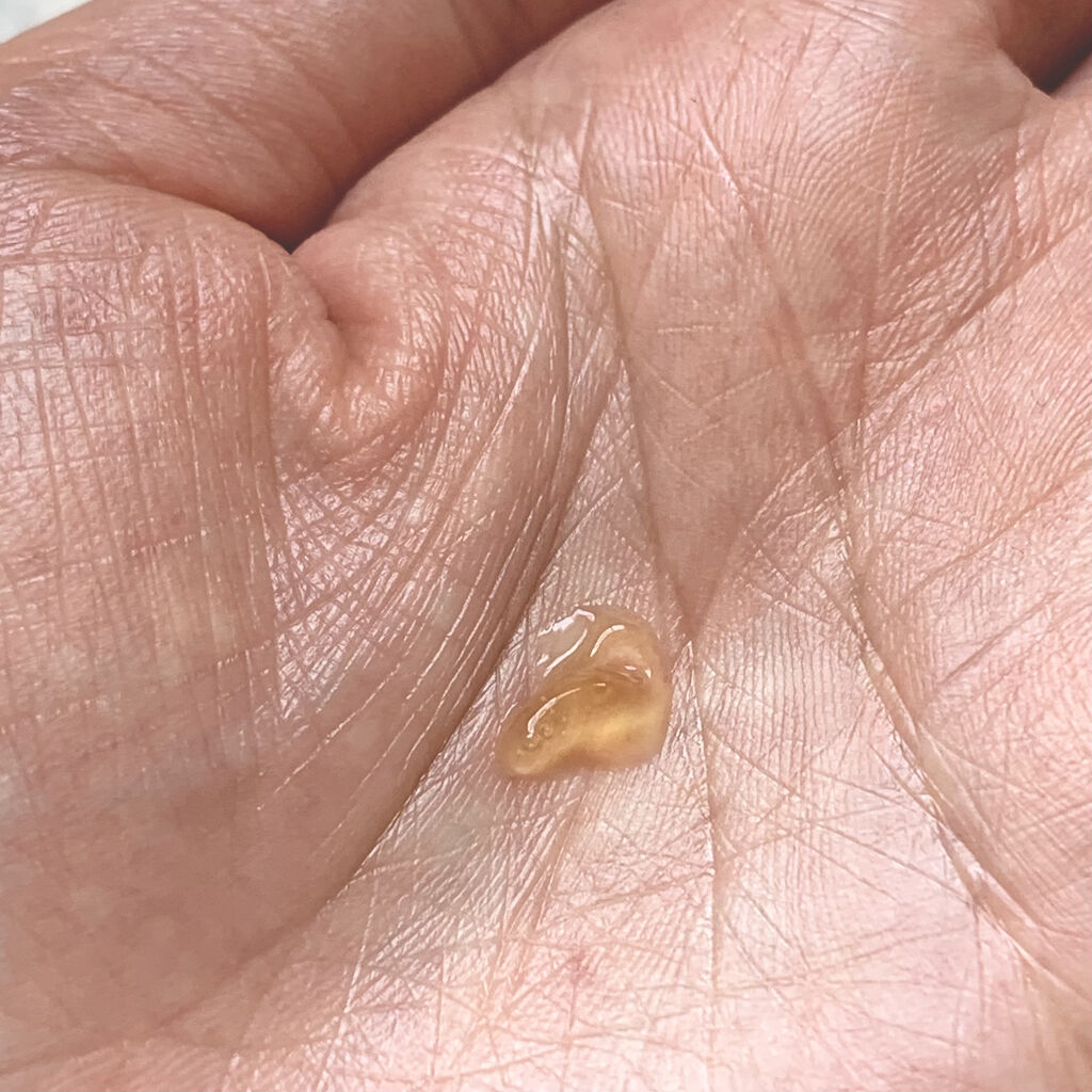 モイスチャージェル1/エンビロン/フェイスクリームを使ったクチコミ（3枚目）