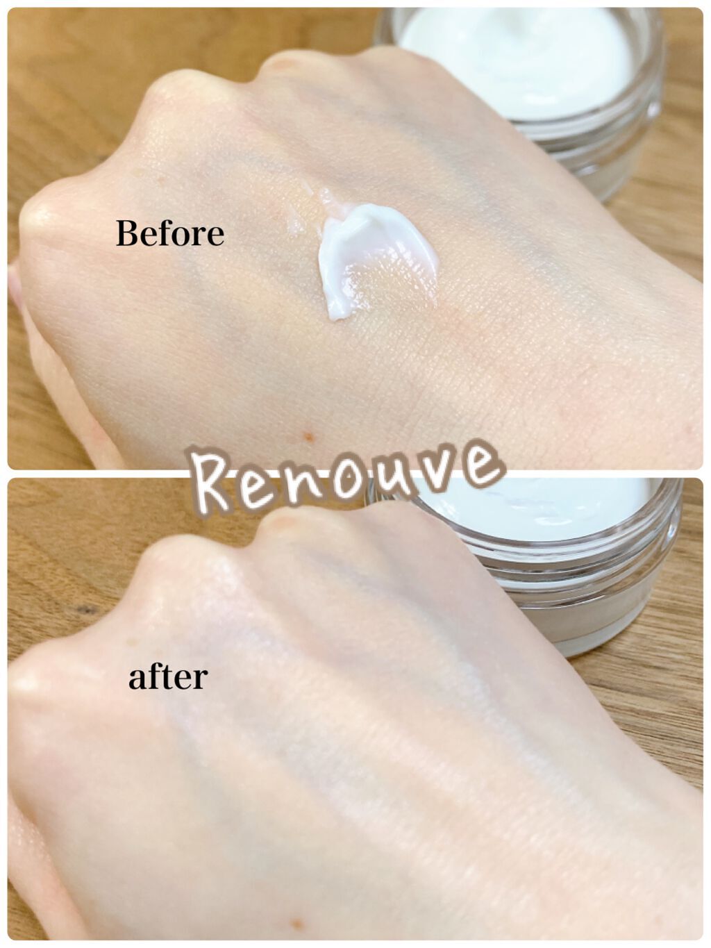 日高 on LIPS 「年々肌悩みが増えていく。いつまでもパンとしたハリや、輝くような..」(7枚目)