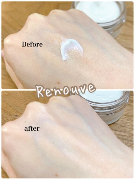 日高 on LIPS 「年々肌悩みが増えていく。いつまでもパンとしたハリや、輝くような..」(7枚目)