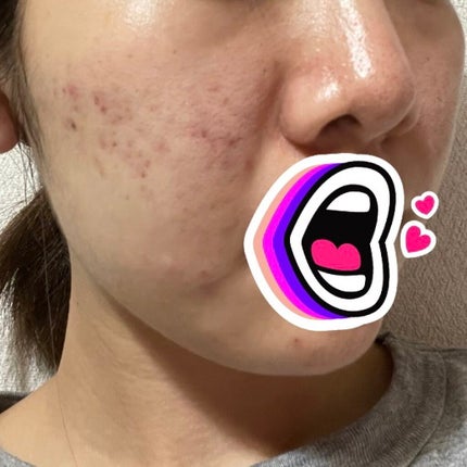 クリアターン ホワイト マスク (ビタミンC)/クリアターン/シートマスク・パックを使ったクチコミ(3枚目)