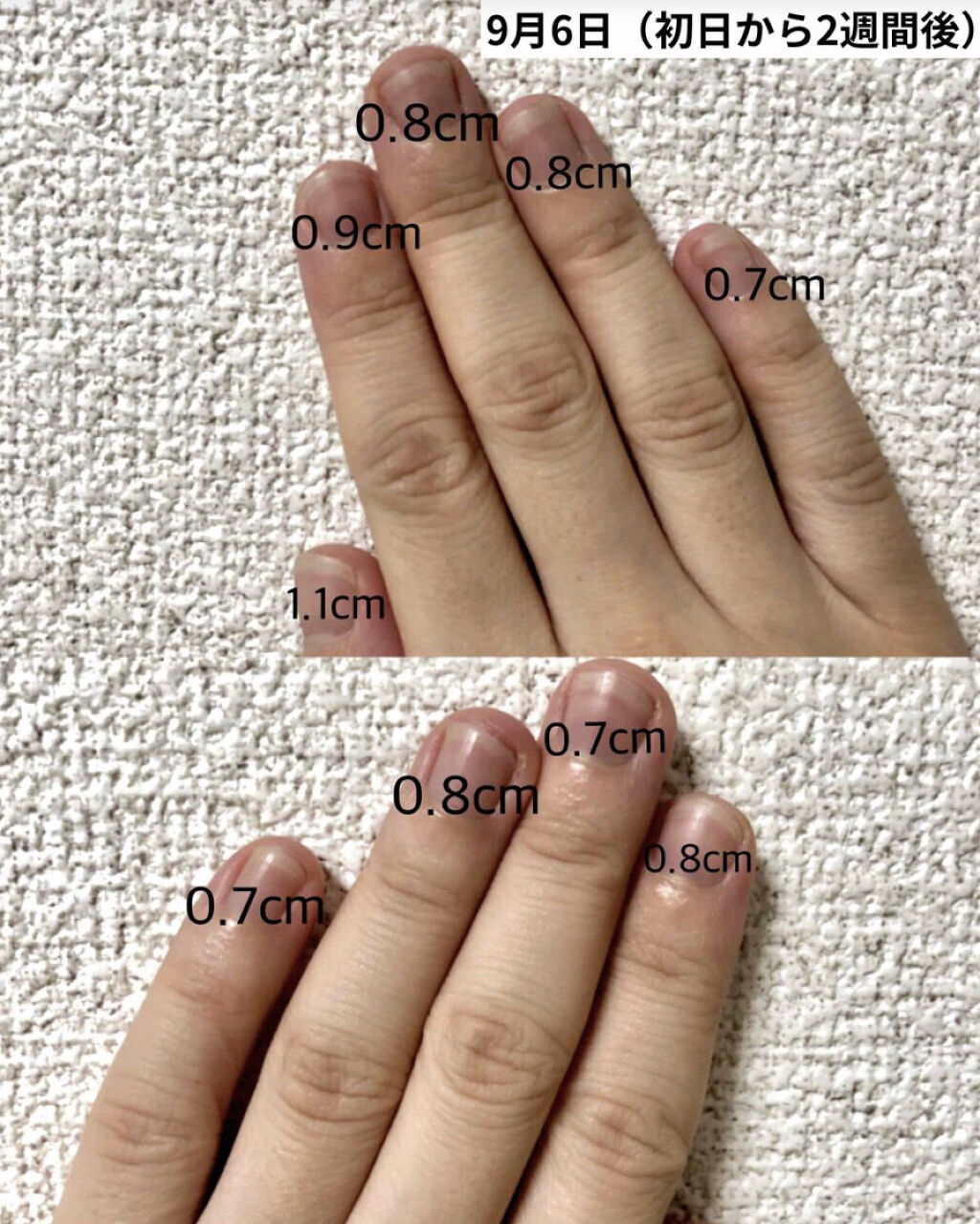 ネイルトリートメント N/ネイルネイル/ネイルオイル・トリートメントを使ったクチコミ（3枚目）