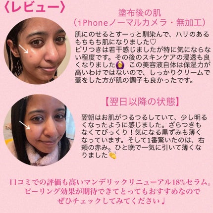 マンデリック インテンシブ 18%セラム/DR.WU/美容液を使ったクチコミ(4枚目)