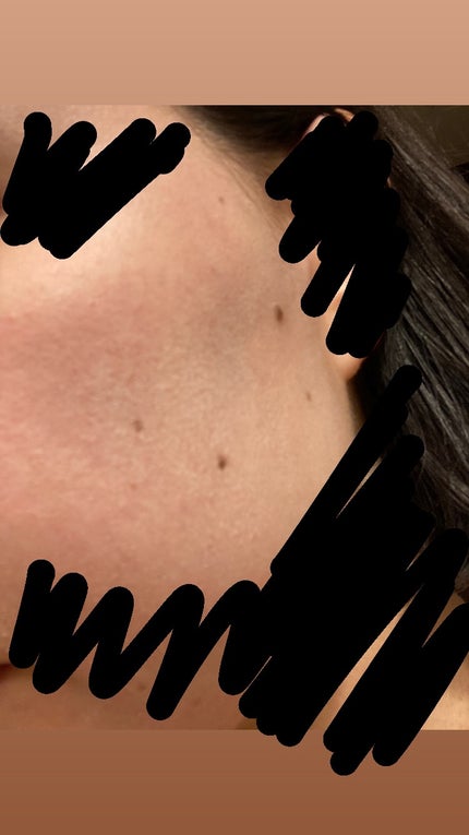 サンカットR ライトアップUV エッセンス/サンカット®/日焼け止めローションを使ったクチコミ(5枚目)