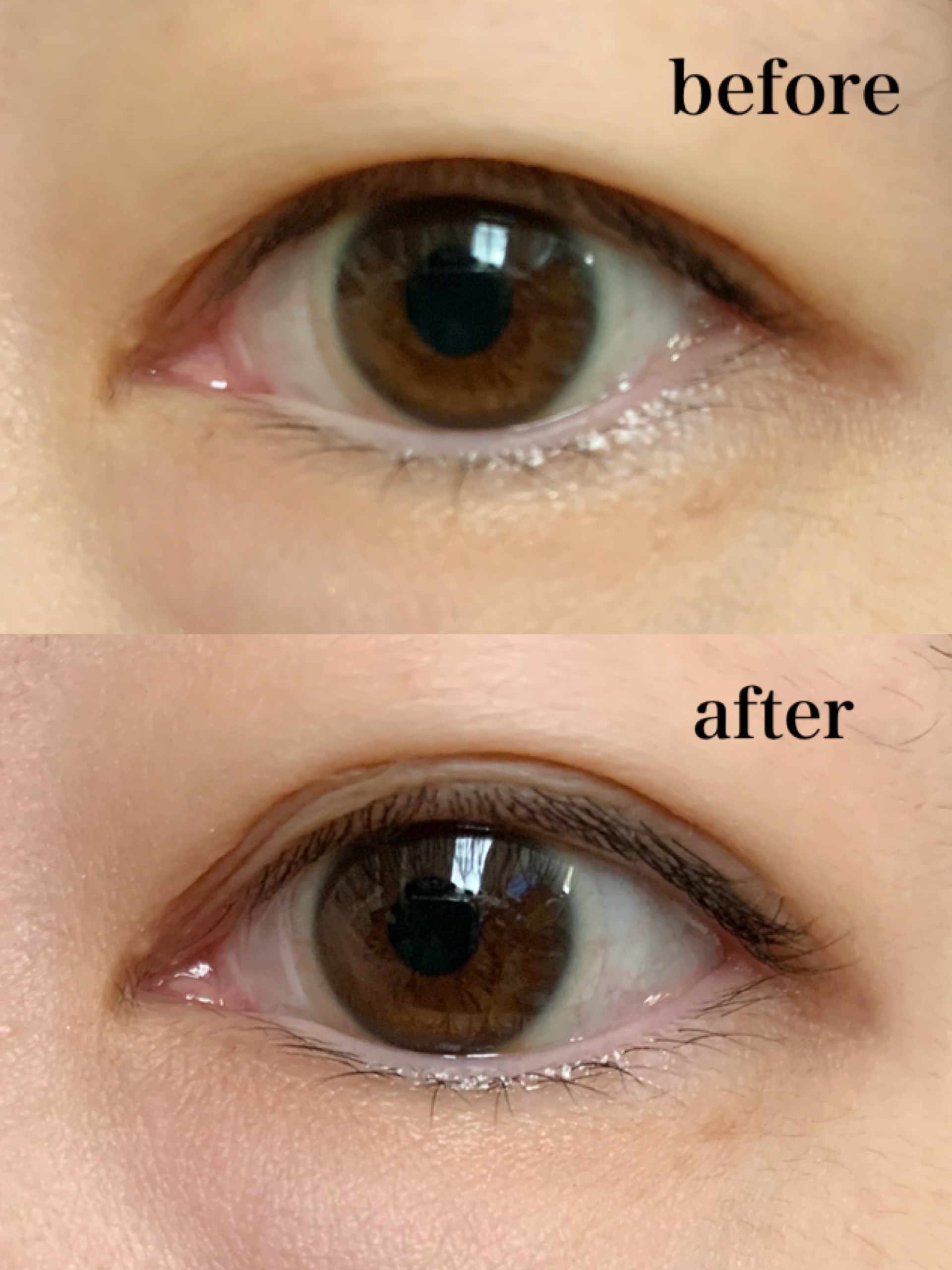 TWOOL ダブルアイリッドグルー/SHOBIDO/二重まぶた用アイテムを使ったクチコミ（2枚目）