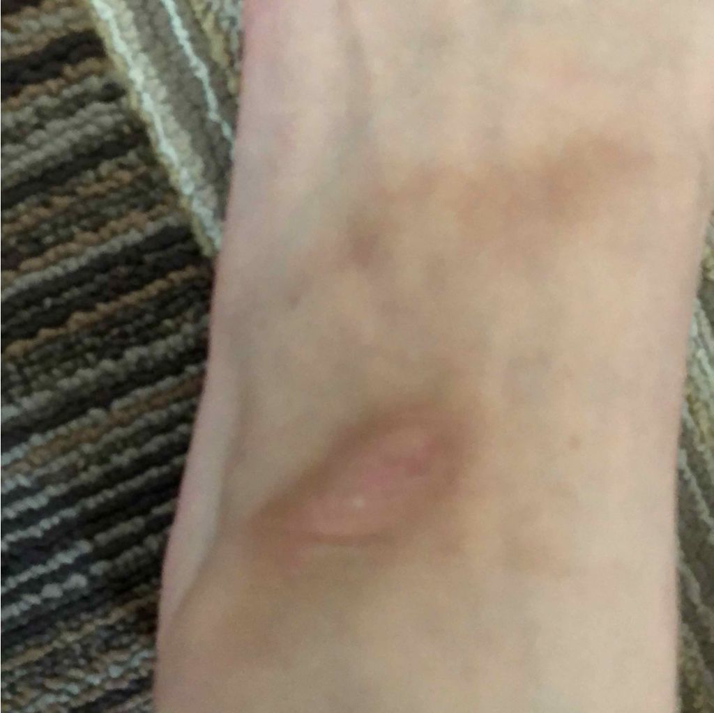 クナイプビオ オイル バーム/クナイプ/フェイスバームを使ったクチコミ（2枚目）