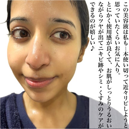 ダークスポットセラム/Anua/美容液を使ったクチコミ(6枚目)