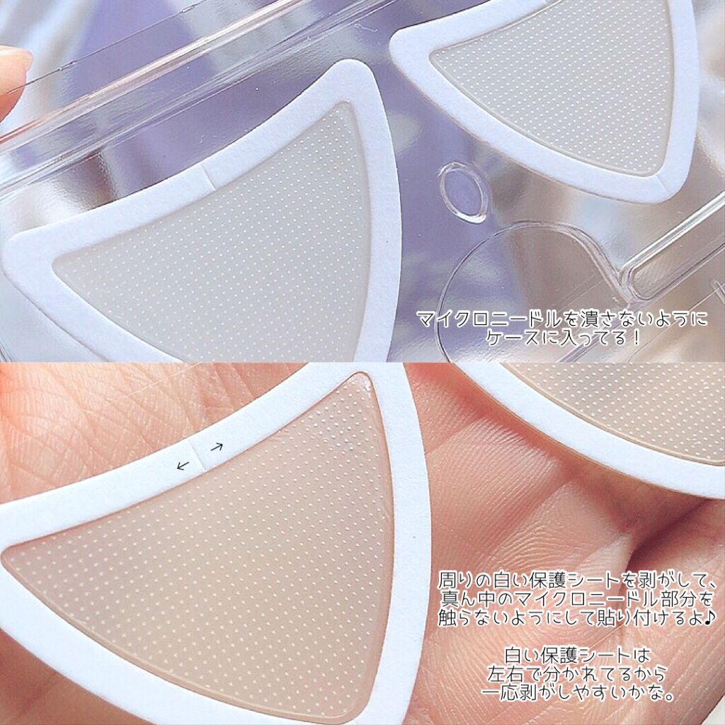 チークポアパッチ/北の快適工房/シートマスク・パックを使ったクチコミ（2枚目）