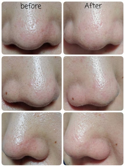 デュオ ザ クレンジングバーム クリア/DUO/クレンジングバームを使ったクチコミ(5枚目)