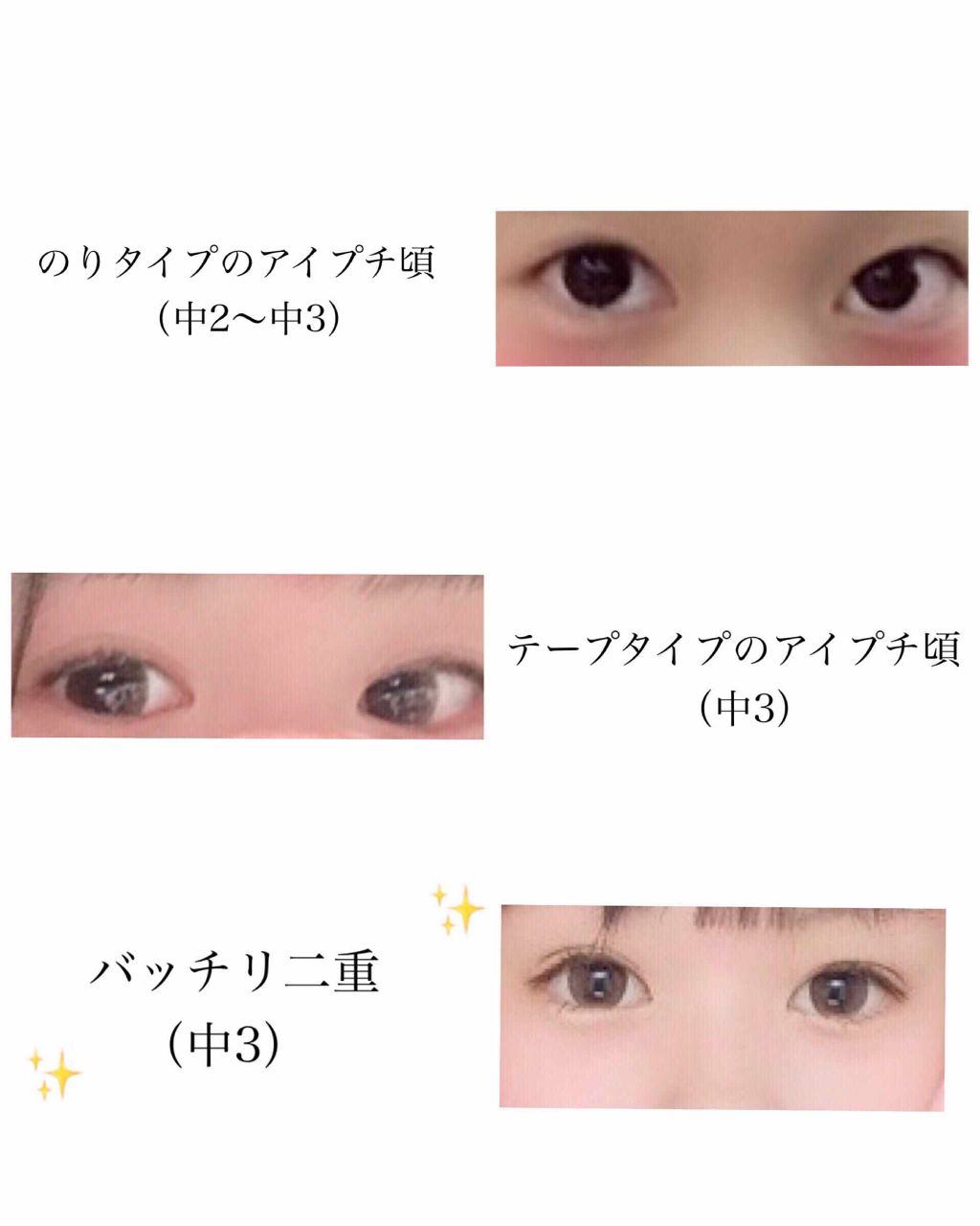 のびーるアイテープ（絆創膏タイプ、レギュラー）/DAISO/二重まぶた用アイテムを使ったクチコミ（3枚目）