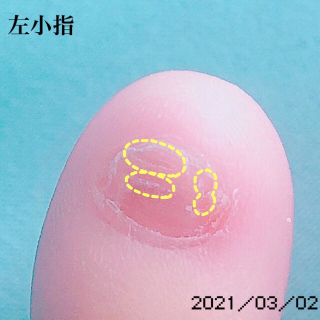 ネイルエンビー/O・P・I/ネイルオイル・トリートメントを使ったクチコミ(5枚目)