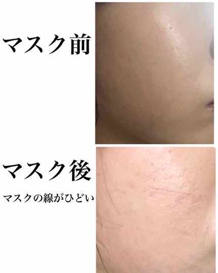 ライトリフレクティングセッティングパウダー プレスト N/NARS/プレストパウダーを使ったクチコミ(3枚目)