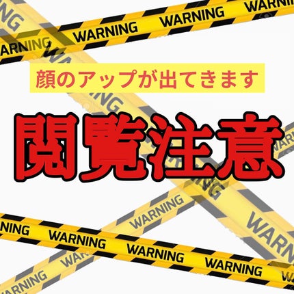 輪郭スッキリQ+/湘南美容/その他を使ったクチコミ(2枚目)