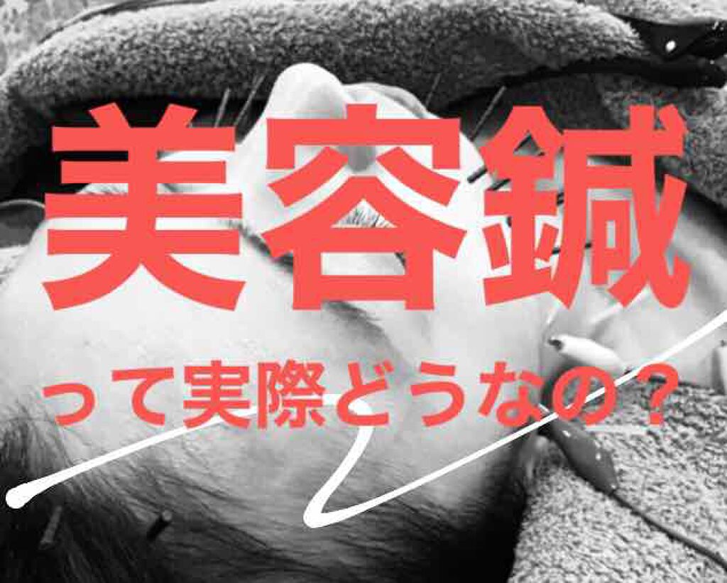 まちる on LIPS 「美容鍼 ハリッチさんに行ってきました!美容鍼には血液の流れをよ..」(1枚目)