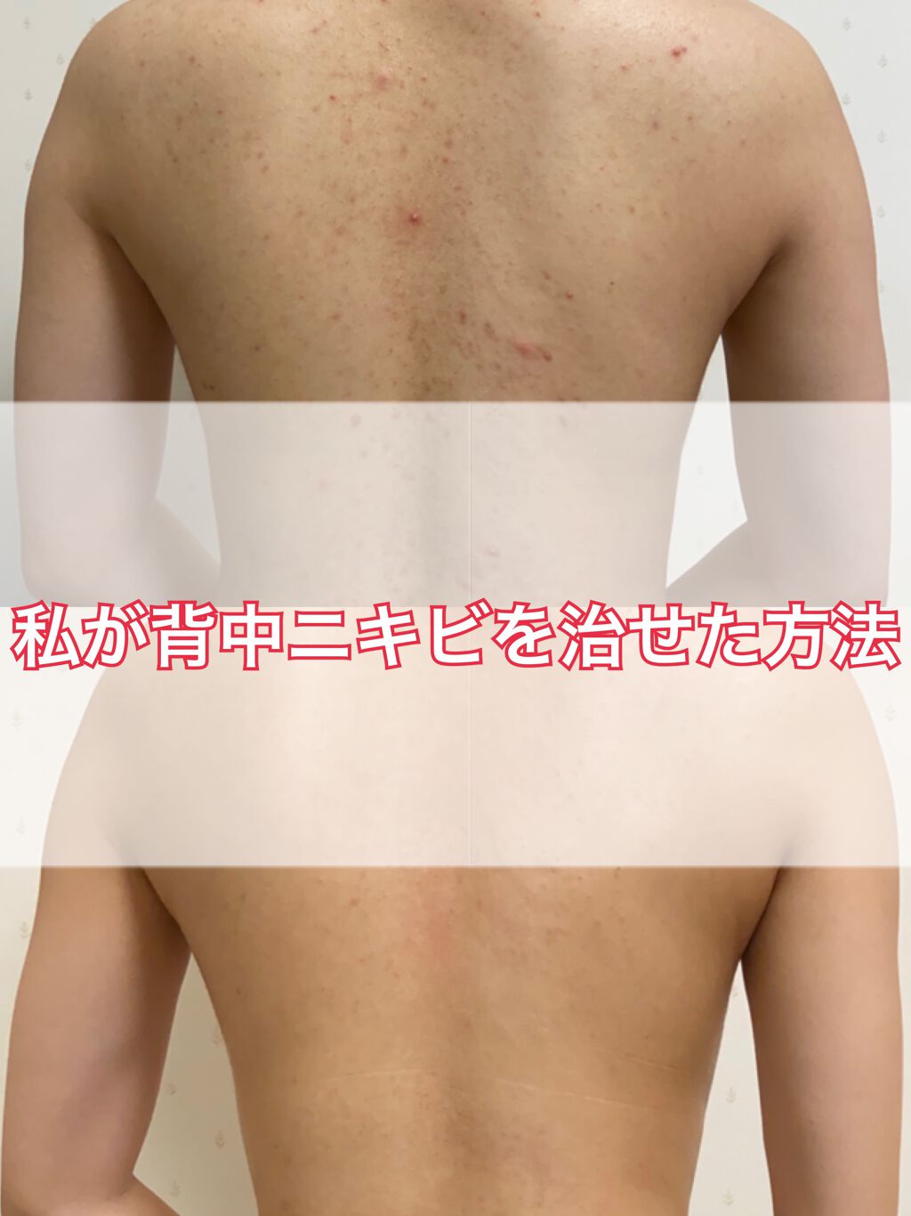 薬用保湿化粧水/オードムーゲ/化粧水を使ったクチコミ(1枚目)