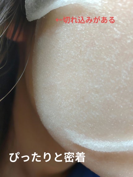 ダーマレーザー スーパーNMN100マスク/クオリティファースト/シートマスク・パックを使ったクチコミ(5枚目)