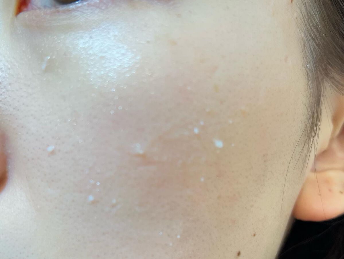 ピールショット/北の快適工房/ピーリングを使ったクチコミ(4枚目)