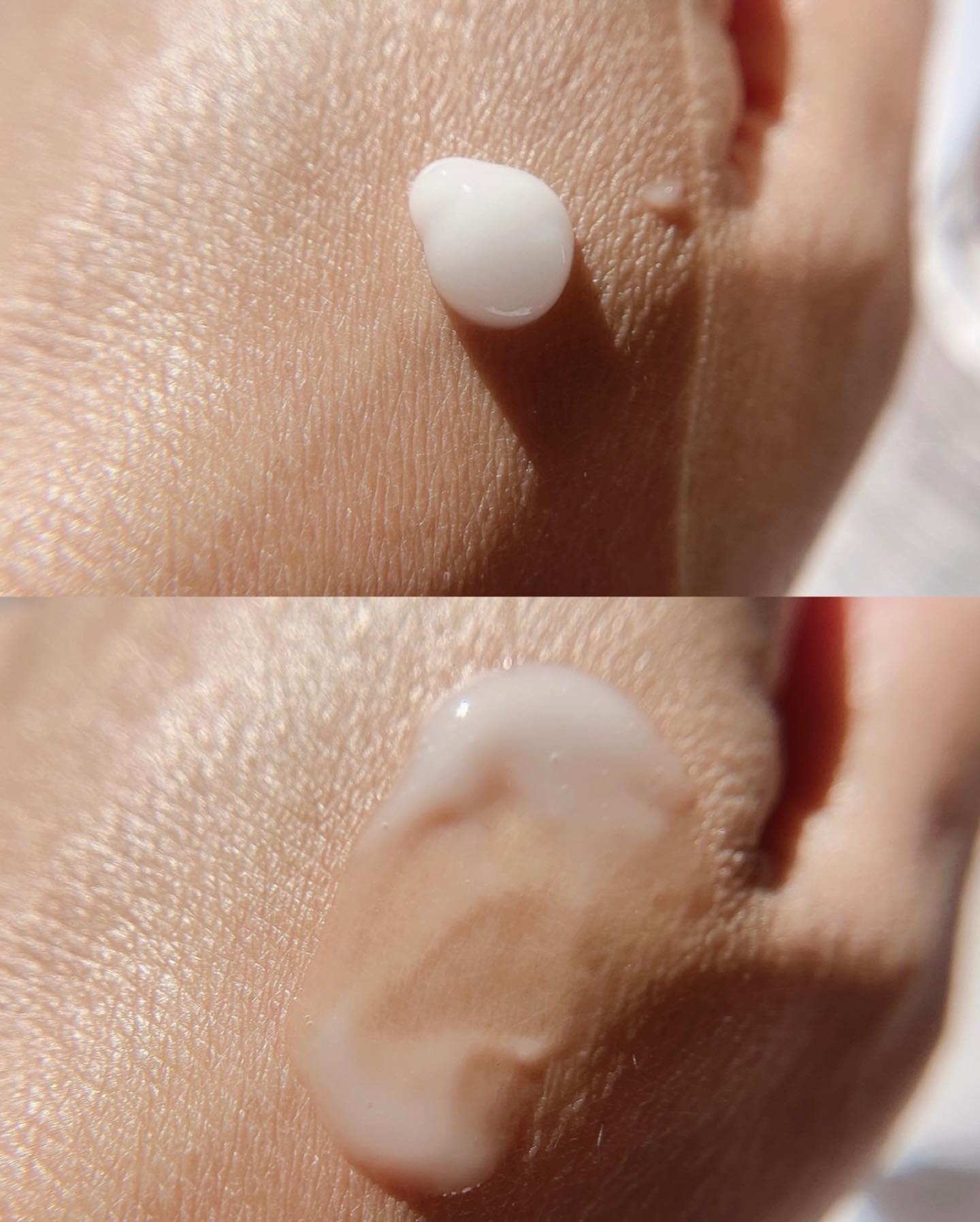 リードルショット100/VT/美容液を使ったクチコミ（3枚目）