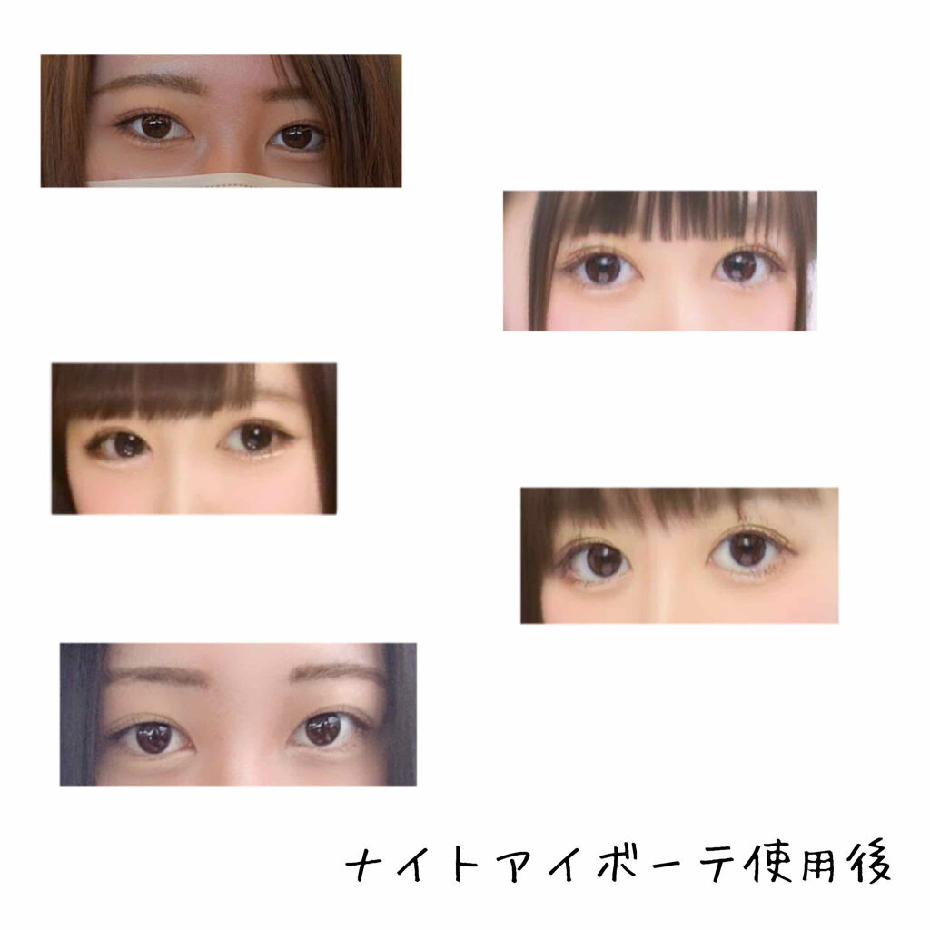ナイトアイボーテ/StreeTrend/二重まぶた用アイテムを使ったクチコミ（3枚目）
