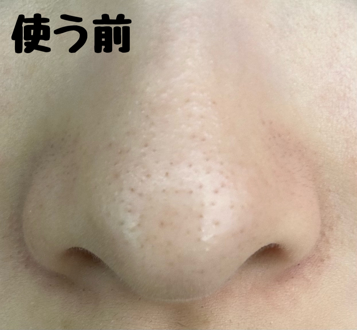 ノーモアブラックヘッド(ノーズピーリング)/One-day's you/スクラブ・ゴマージュを使ったクチコミ（2枚目）